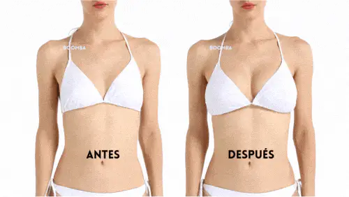 Antes y despues allure